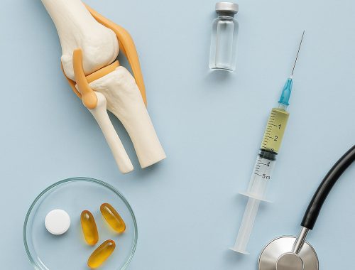 Was Hyaluron mit PRP, Chondroitin oder Kortison leisten kann
